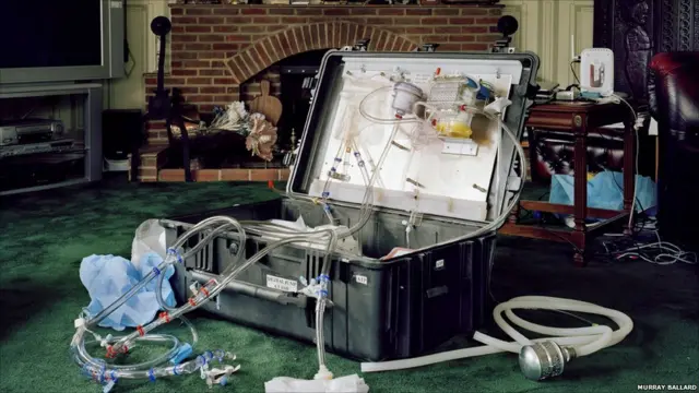 فریز کردن انسان