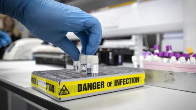 Laboratorio de pruebas de coronavirus.