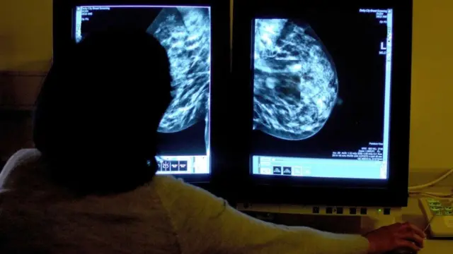 Због начина на који се нуди преглед рака, трансродни мушкарци ће често пропустити виталне прегледе који могу открити знаке рака дојке