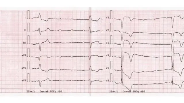 પ્રતીકાત્મક તસવીર