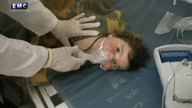 کودکی در خان شیخون که مورد حمله شیمایی قرار گرفته است