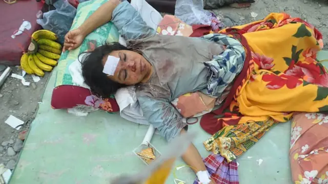 伤势严重的妇女在医院休息