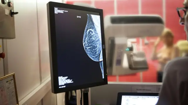 Скан грудей