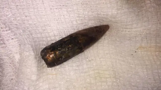 வெளியே எடுக்கப்பட்ட துப்பாக்கி தோட்டா