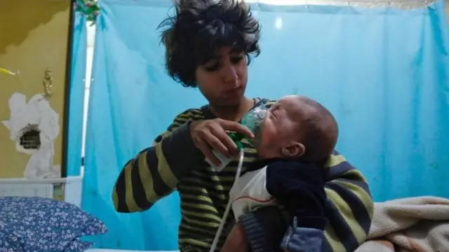 કેમિકલ હુમલા બાદ બાળકની સારવાર