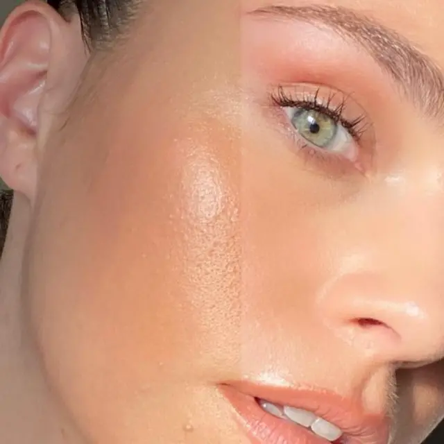 ساشا بالاري تقارن بين صورتين لبشرتها مع وبدون فلتر