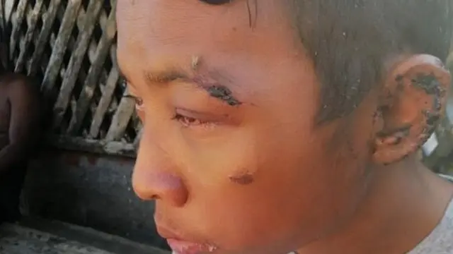 ကိုမြတ်သူရထွန်းရဲ့အသိပေးမှုကြောင့် အလားတူလူကုန်ကူးခံရသူ၂ဦးထဲက တစ်ဦးပြန်လွတ်လာ