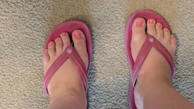 Hatahivyo hatimaye Kimbelry alipata huduma aliokuwa akiihitaji