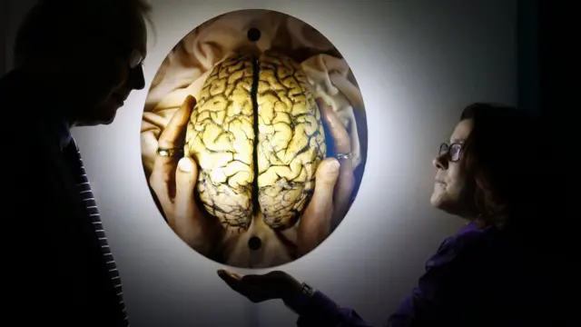 Escena en una exposición de arte frente a la imagen de un cerebro.