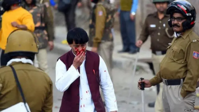 ਦਿੱਲੀ ਹਿੰਸਾ ਵਿੱਚ ਜਖ਼ਮੀ ਹੋਇਆ ਆਦਮੀ