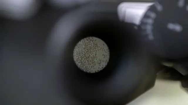 Cells which produce antibodies are seen under a microscope