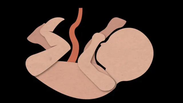 Gráfico de un feto humano.