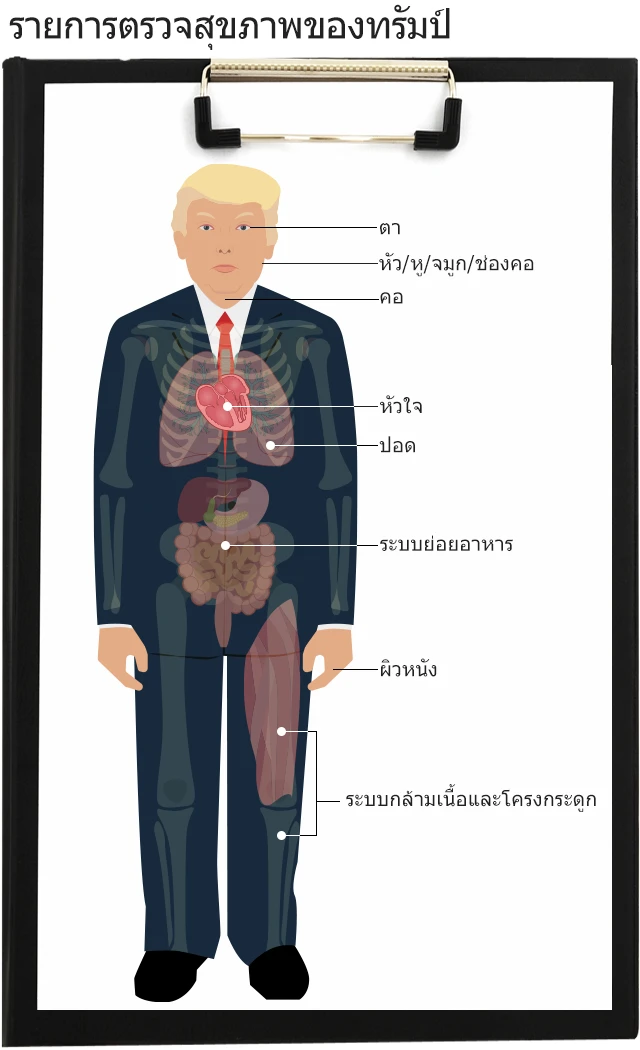 กราฟิกทรัมป์ตรวจสุขภาพ