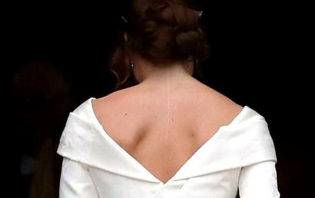 Detalhe das costas do vestido de noiva da princesa Eugenie, deixando a cicatriz à mostra