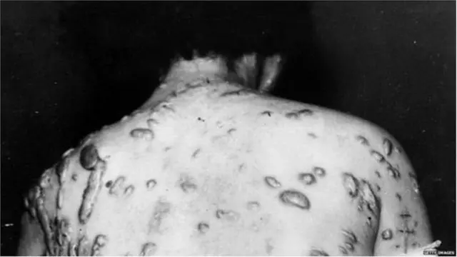 నేను చనిపోతానా?