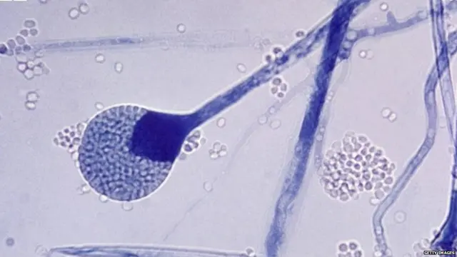 ਕਾਲੀ ਫੰਗਸ