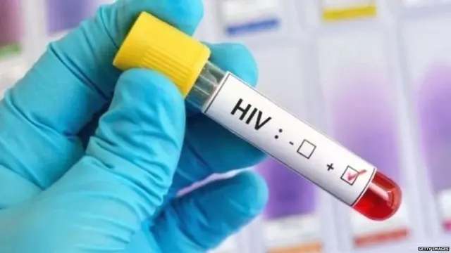 HIV