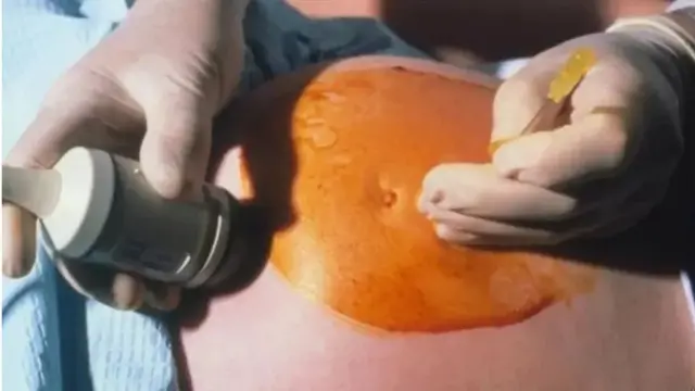 علامتی تصویر