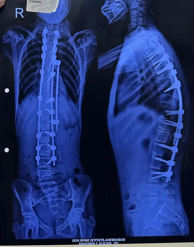 સિવિલ હોસ્પિટલ મીડિયાને આપેલ એકસરે