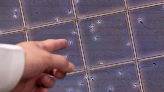 புற்றுநோய் ஏற்படுத்தும் மரபணுவை கொண்ட நபர் மூலம் பிறந்த சுமார் 200 குழந்தைகள் - என்ன நேர்ந்தது?