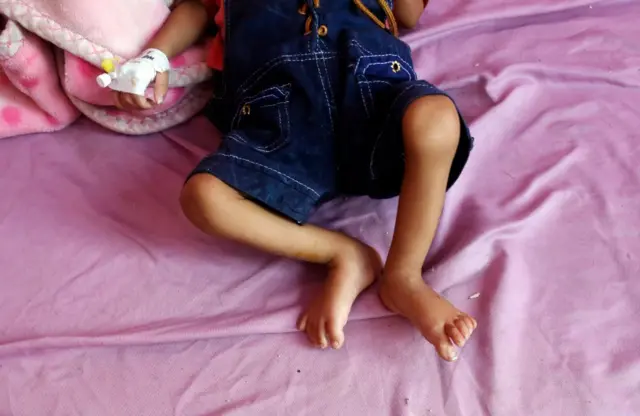 بیش از ۲۳ میلیون نفر که سه چهارم جمعیت این کشور می‌شود، به کمک بشردوستانه نیاز دارند