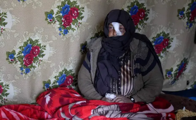 عايدة ترتدي لباساً واسعاً وحجاباً وتتغطى بلحاف أحمر، ويظهر وجهها مصاباً تلف جزءاً منه بشاش طبي، تحديداً في المنطقة فوق الأنف