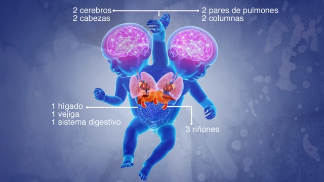 Ilustración de los órganos internos de las niñas