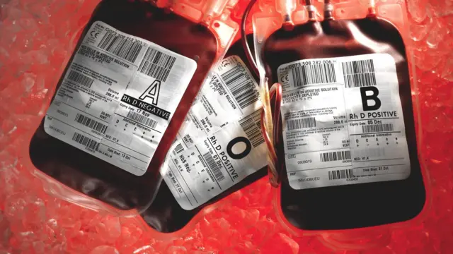 प्रातिनिधिक