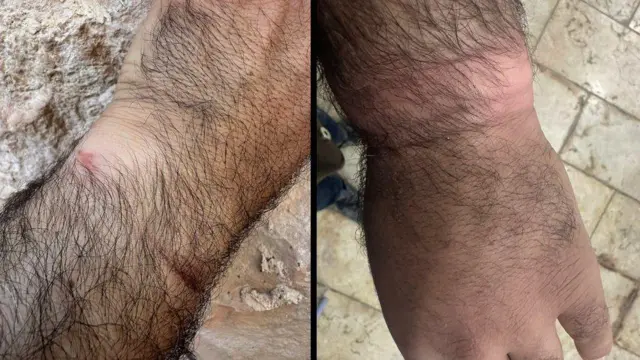 इस्सा अमरोने बीबीसीला सांगितलं की, 7 ऑक्टोबर रोजी जेव्हा त्याला IDF ने ताब्यात घेतले तेव्हा त्याचे हात इतके घट्ट बांधलेले होते की त्यामुळे त्याचे रक्ताभिसरण बंद झाले.