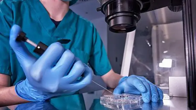 ਸ਼ੁਕਰਾਣੂ