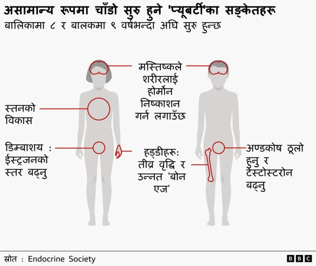 असामान्य रूपमा चाँडो सुरु हुने प्यूबर्टीका सङ्केतहरू बुझाउने तस्बिर