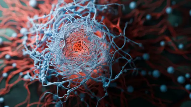 சினைப்பை புற்றுநோய்