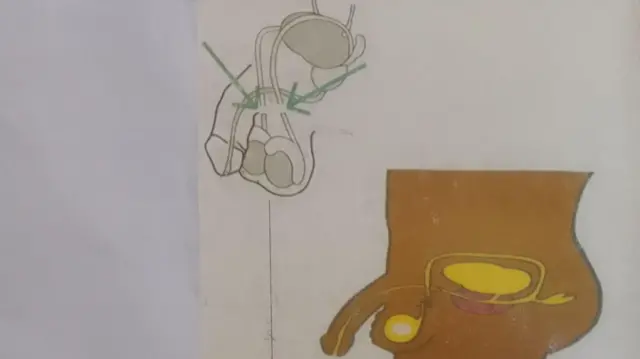 Uturingoti tujana imbuto z'umugabo