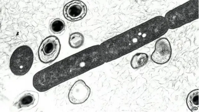 Anthrax bacterium dem show for one 2001 US defence department