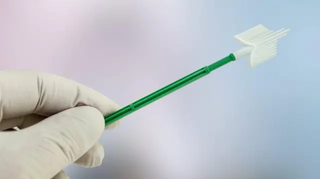 'प्याप स्मिअर' नामक परीक्षणबाट पाठेघरको मुखमा क्यान्सर भएको वा नभएको पत्ता लगाइन्छ