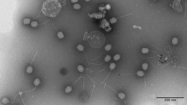 Электрон микроскопда ўнлаб "Галлаҳер-фаг"и кўринади. 