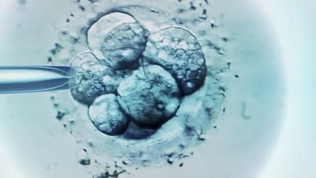 انتقاء الأجنة في التلقيح الاصطناعي