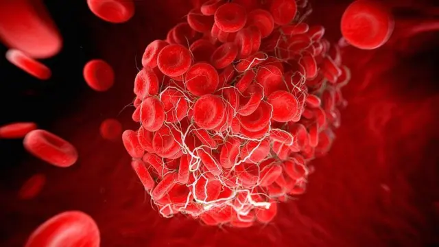 ምርጋእ ደም መፍሰስቲ ደም ንምክልኻል ዝሕግዝ ንቡር መስርሕ እዩ