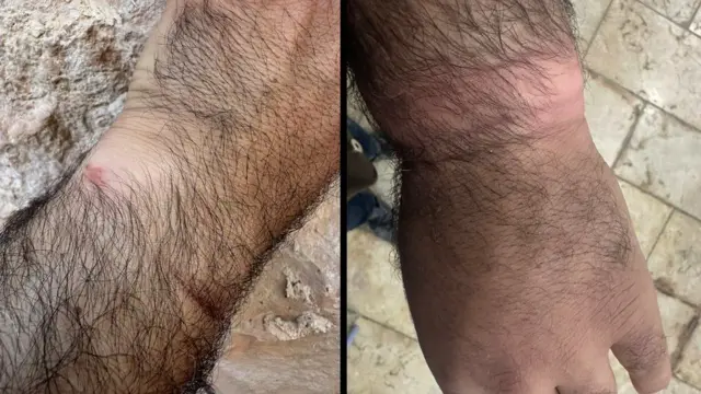 इसा आमरो ने कहा कि 7 अक्टूबर को इसराइली सेना ने उन्हें हिरासत में ले लिया. उनका हाथ इतना कस कर बांधा गया था कि नसें भी सुन्न पड़ गई थीं.