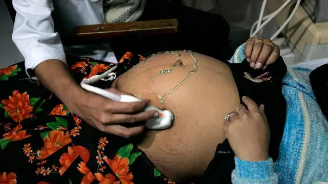 లింగ నిర్ధరణ పరీక్ష