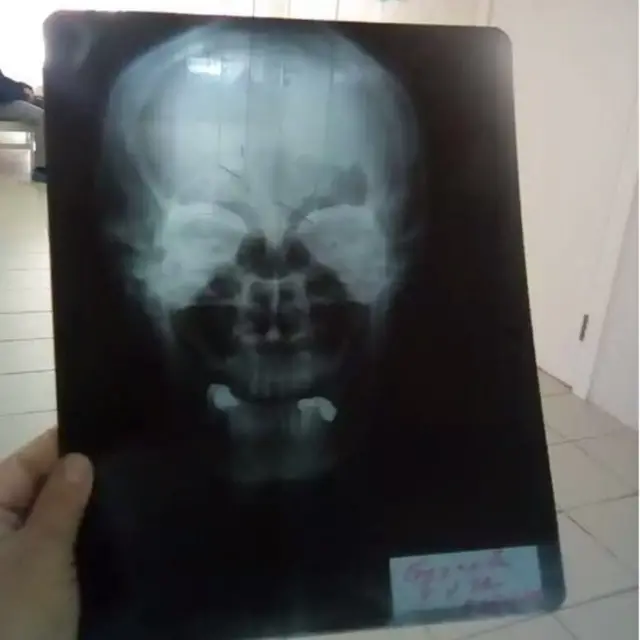 Бош чаноғи сурати