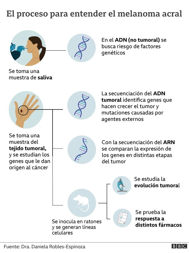Melanoma acral