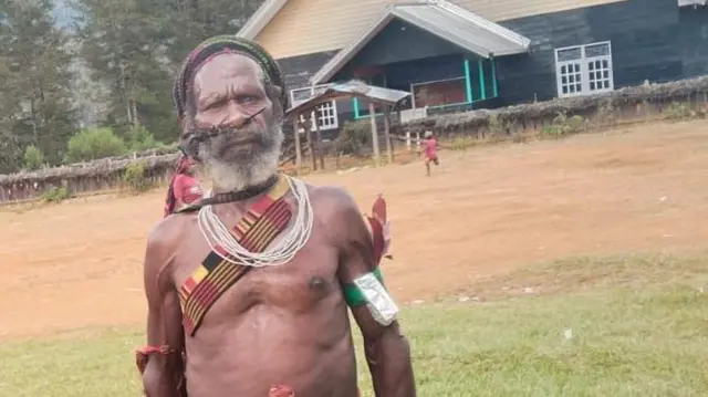 Seorang warga Kabupaten Puncak bernama Enikmbak Murib diduga tewas tertembak.