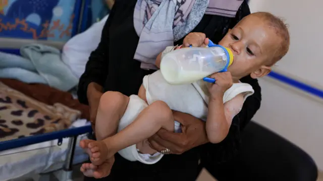 ائشة وهدان، والدة حاتم البالغ من العمر 8 أشهر، والذي يتلقى العلاج من سوء التغذية، تطعمه الحليب في مستشفى الرنتيسي، وسط نقص حاد في حليب الأطفال، في مدينة غزة