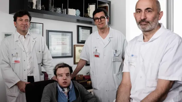 นายอามง และทีมแพทย์ที่ปลูกถ่ายใบหน้า