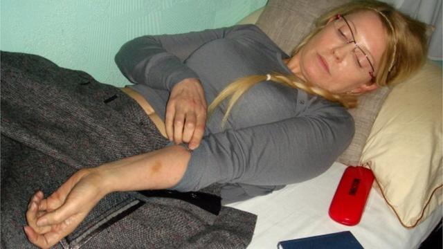 За решеткой здоровье Тимошенко быстро ухудшается, она не может ходить, на теле появляются синяки