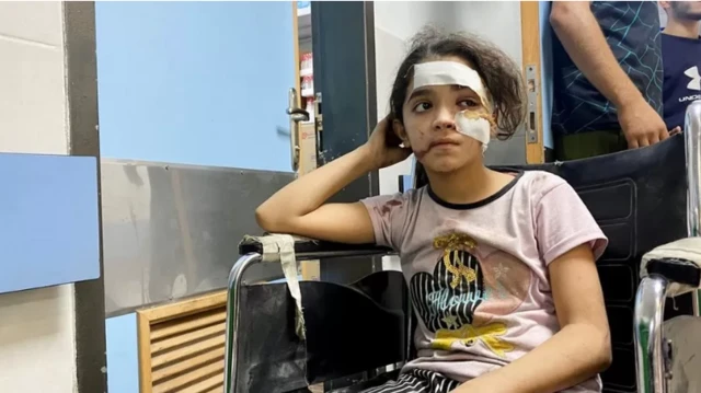 গাজায় ইসরায়েলি অভিযানে আহত শিশু