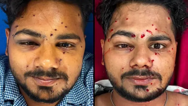 దిల్లీ జంతర్ మంతర్, కాక్రోచ్ పార్టీ నిరసన, పెల్లెట్ కాల్పులు, గాయాలు