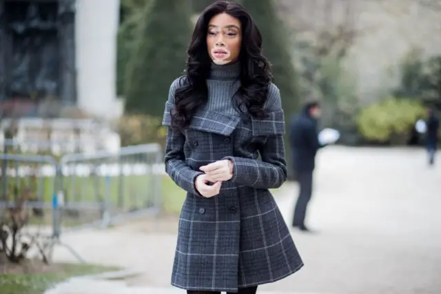 विनी हार्लो या आजाराने ग्रस्त आहेत आणि मॉडेलिंगच्या जगात त्या सुप्रसिद्ध आहेत 