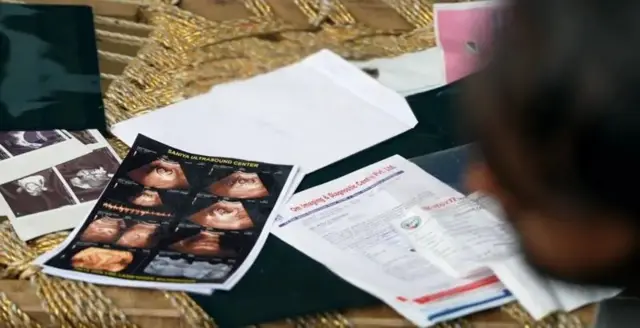  চিকিৎসকেরা জানিয়েছেন, এই জাতীয় ঘটনা বেশ বিরল। 